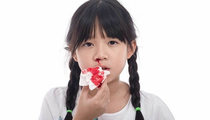 Bạn mơ thấy chảy máu cam nên đặt cược vào con số nào để thắng lớn?