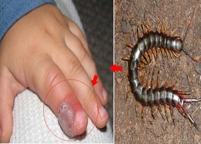 Nên đặt cược con số nào nếu mơ thấy rết cắn? Nếu bạn mơ thấy mình bị rết cắn chảy máu thì hãy đặt cược ngay vào con số may mắn: 43 – 54. Cẩm nang lý giải hiện tượng nằm mơ thấy rết cắn bật mí gì?