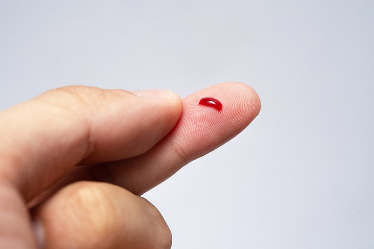 Nằm mơ thấy kim đâm vào tay có ý nghĩa gì? Đặt cược vào con số nào để may mắn?