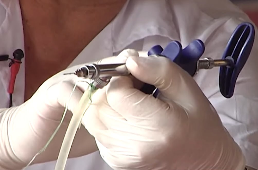 Hướng dẫn cách tiêm vacxin cho gà - Niên Giám Nông Nghiệp